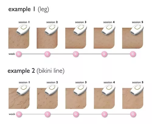 Depiladora Laser Ipl Permanente