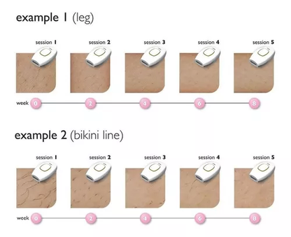 Depiladora Laser Ipl Permanente